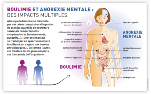 Infographie désordres alimentaires boulimie anorexie TCA